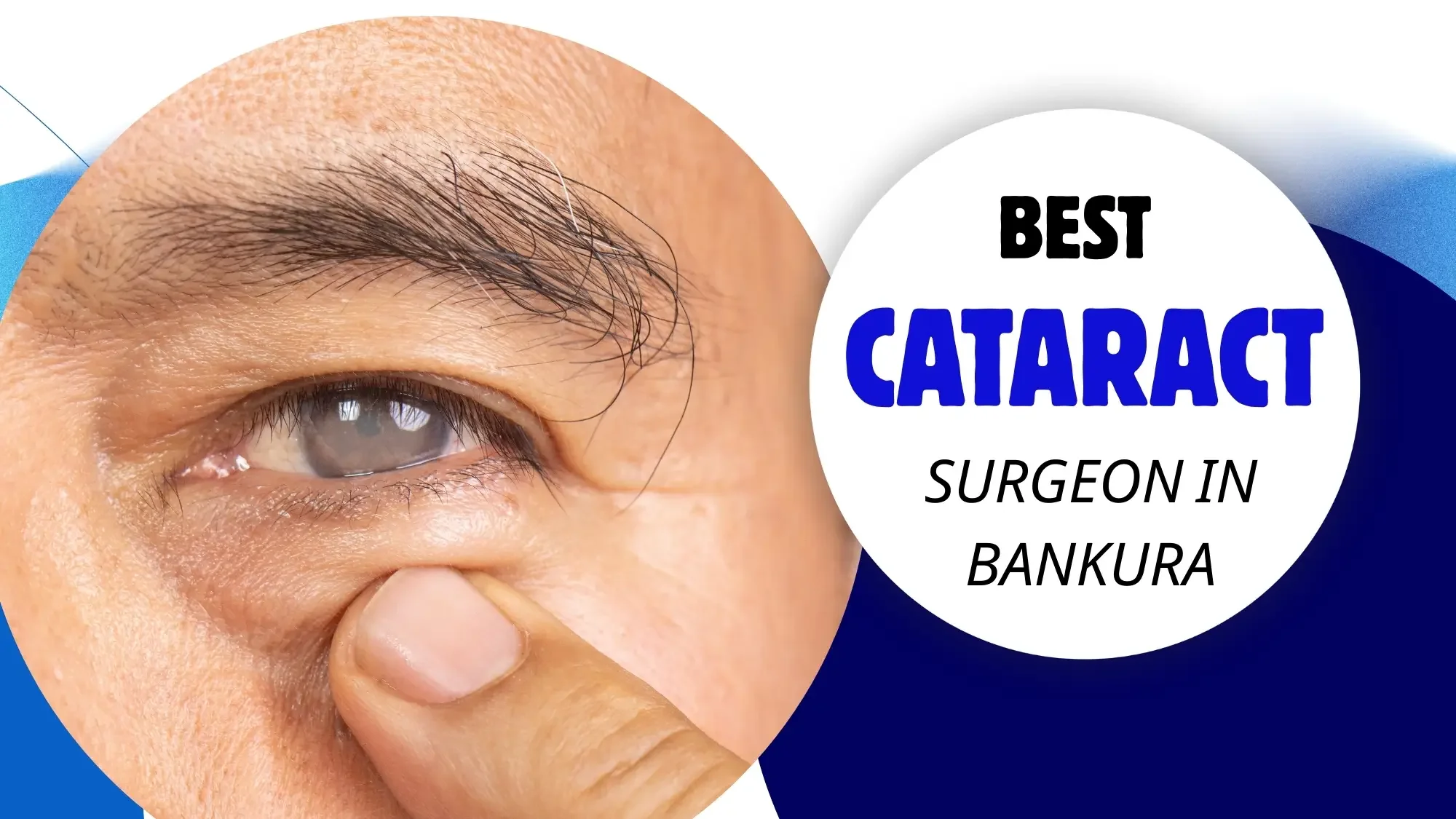 Best Cataract Surgeons In Bankura