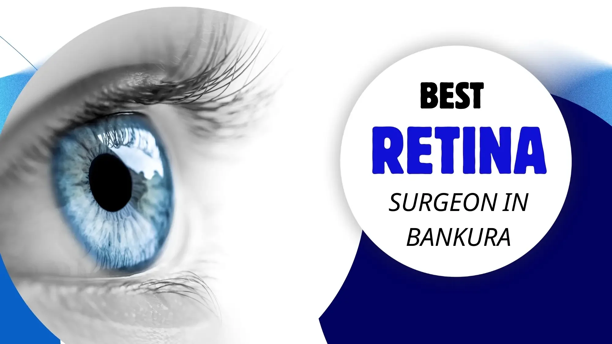 Best Retina Surgeons in Bankura